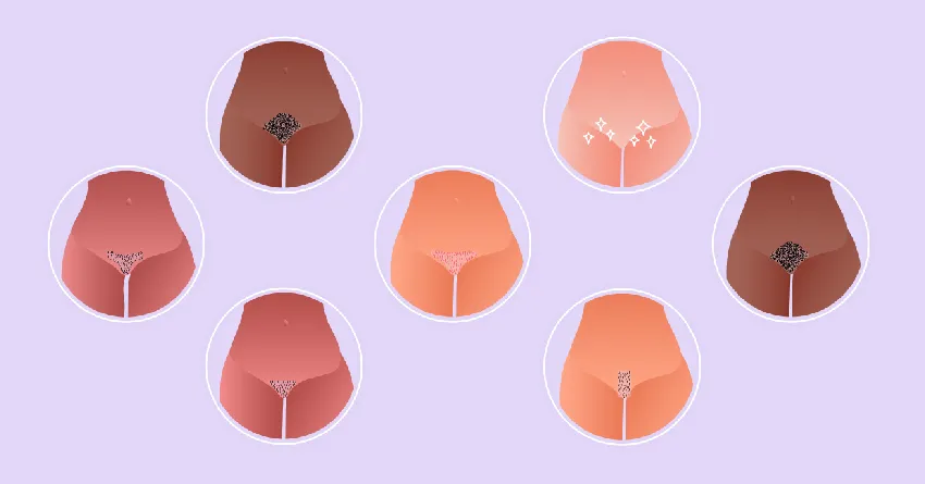 Часто задаваемые вопросы