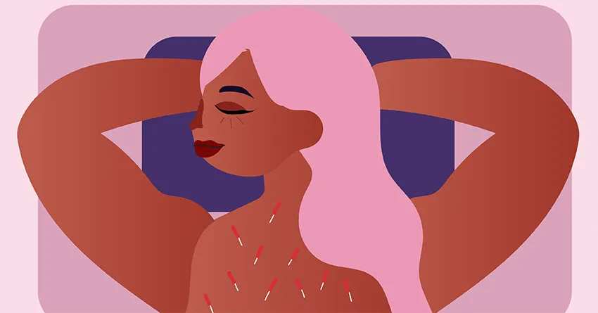 Иглоукалывание и акупрессура