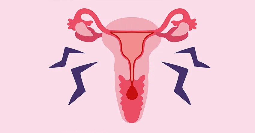 Типы менструальных болей