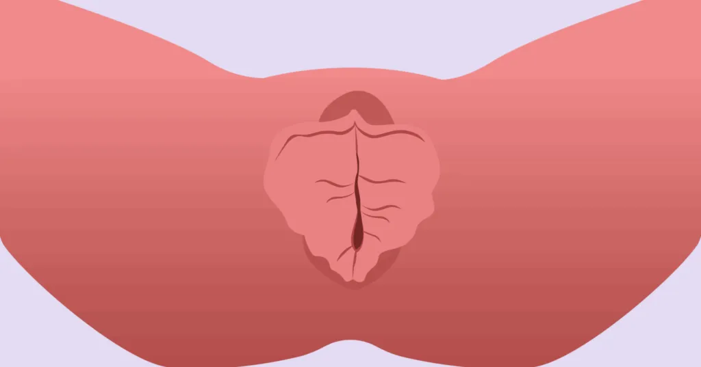 Видимые внутренние губы