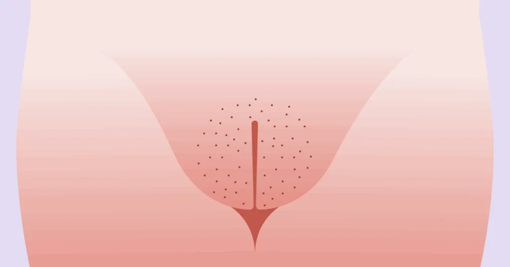 Выдающиеся внешние губы