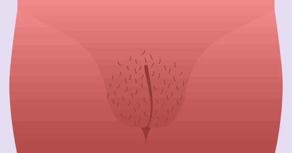 Длинные, свисающие внешние губы