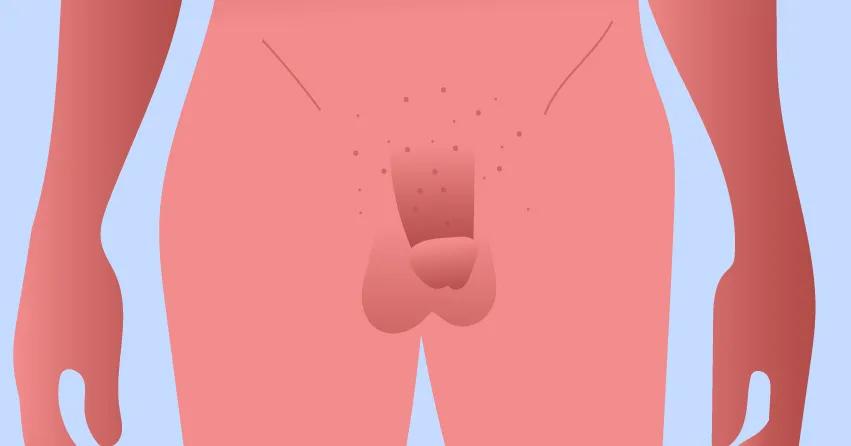 Веснушчатый