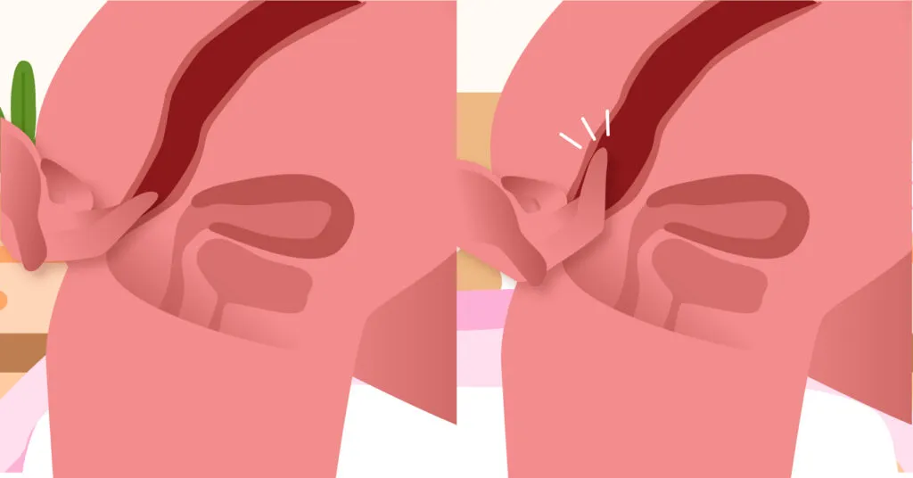 Иди сюда анал