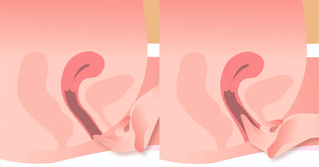 Внутрь и наружу