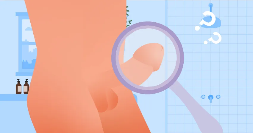 Часто задаваемые вопросы (пенис)